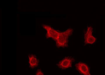 CYP2A6 Antibody - Staining HeLa cells by IF/ICC. The samples were fixed with PFA and permeabilized in 0.1% Triton X-100, then blocked in 10% serum for 45 min at 25°C. The primary antibody was diluted at 1:200 and incubated with the sample for 1 hour at 37°C. An Alexa Fluor 594 conjugated goat anti-rabbit IgG (H+L) Ab, diluted at 1/600, was used as the secondary antibody.