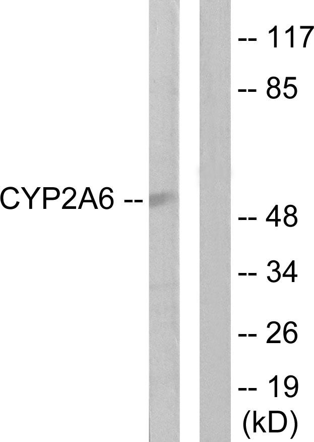 CYP2A6 Antibody - Western blot analysis of extracts from Jurkat cells, using Cytochrome P450 2A6 antibody.