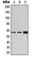 CYP2A6 Antibody - Western blot analysis of Cytochrome P450 2A6 expression in HeLa (A); Jurkat (B); MCF7 (C) whole cell lysates.