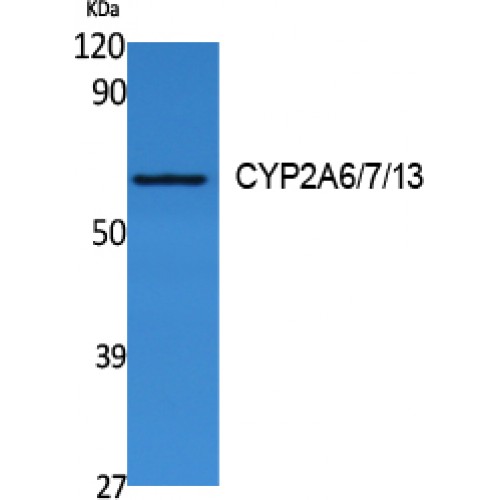 CYP2A6 + CYP2A7 + CYP2A13 Antibody - Western blot of CYP2A6/7/13 antibody