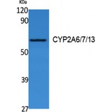 CYP2A6 + CYP2A7 + CYP2A13 Antibody - Western blot of CYP2A6/7/13 antibody
