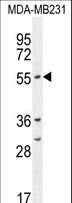 CYP2A7 Antibody - CYP2A7 Antibody western blot of MDA-MB231 cell line lysates (35 ug/lane). The CYP2A7 antibody detected the CYP2A7 protein (arrow).