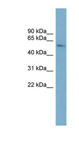 CYP2A7 Antibody - CYP2A7 antibody Western blot of ACHN lysate. This image was taken for the unconjugated form of this product. Other forms have not been tested.