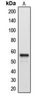CYP2A7 Antibody - Western blot analysis of Cytochrome P450 2A7 expression in A549 (A) whole cell lysates.