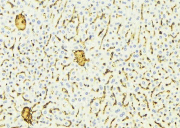 CYP2A7 Antibody - 1:100 staining mouse liver tissue by IHC-P. The sample was formaldehyde fixed and a heat mediated antigen retrieval step in citrate buffer was performed. The sample was then blocked and incubated with the antibody for 1.5 hours at 22°C. An HRP conjugated goat anti-rabbit antibody was used as the secondary.