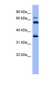 CYP2B6 Antibody - CYP2B6 antibody Western blot of THP-1 cell lysate. This image was taken for the unconjugated form of this product. Other forms have not been tested.