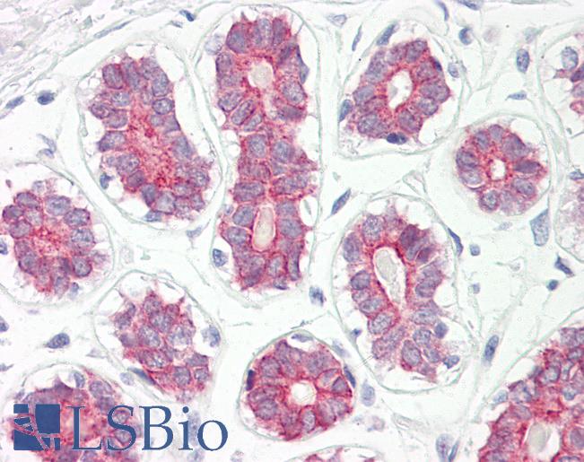 CYP2B6 Antibody - Anti-CYP2B6 antibody IHC of human breast. Immunohistochemistry of formalin-fixed, paraffin-embedded tissue after heat-induced antigen retrieval. Antibody dilution 5-7.5 ug/ml.  This image was taken for the unconjugated form of this product. Other forms have not been tested.