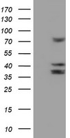 CYP2B6 Antibody - HEK293T cells were transfected with the pCMV6-ENTRY control (Left lane) or pCMV6-ENTRY CYP2B6 (Right lane) cDNA for 48 hrs and lysed. Equivalent amounts of cell lysates (5 ug per lane) were separated by SDS-PAGE and immunoblotted with anti-CYP2B6.