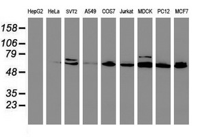 CYP2B6 Antibody - Western blot of extracts (35ug) from 9 different cell lines by using anti-CYP2B6 monoclonal antibody (HepG2: human; HeLa: human; SVT2: mouse; A549: human; COS7: monkey; Jurkat: human; MDCK: canine; PC12: rat; MCF7: human).