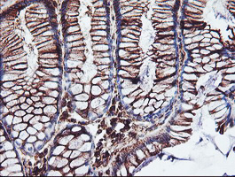 CYP2B6 Antibody - IHC of paraffin-embedded Human colon tissue using anti-CYP2B6 mouse monoclonal antibody. (Heat-induced epitope retrieval by 10mM citric buffer, pH6.0, 100C for 10min).