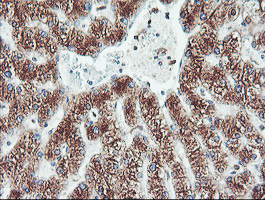 CYP2B6 Antibody - IHC of paraffin-embedded Human liver tissue using anti-CYP2B6 mouse monoclonal antibody. (Heat-induced epitope retrieval by 10mM citric buffer, pH6.0, 100C for 10min).