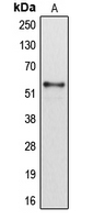 CYP2B6 Antibody - Western blot analysis of Cytochrome P450 2B6 expression in HepG2 (A) whole cell lysates.
