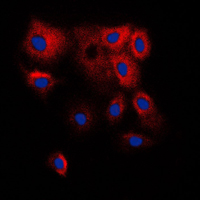 CYP2B6 Antibody - Immunofluorescent analysis of Cytochrome P450 2B6 staining in HepG2 cells. Formalin-fixed cells were permeabilized with 0.1% Triton X-100 in TBS for 5-10 minutes and blocked with 3% BSA-PBS for 30 minutes at room temperature. Cells were probed with the primary antibody in 3% BSA-PBS and incubated overnight at 4 C in a humidified chamber. Cells were washed with PBST and incubated with a DyLight 594-conjugated secondary antibody (red) in PBS at room temperature in the dark. DAPI was used to stain the cell nuclei (blue).