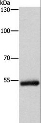 CYP2B6 Antibody - Western blot analysis of Human colon cancer tissue, using CYP2B6 Polyclonal Antibody at dilution of 1:400.