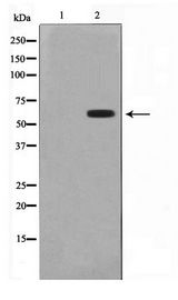 CYP2B6 Antibody - Western blot of HT29 cell lysate using Cytochrome P450 2B6 Antibody