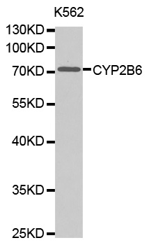 CYP2B6 Antibody - Western blot analysis of extracts of K562 cell lines.