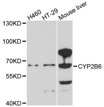 CYP2B6 Antibody - Western blot analysis of extracts of various cell lines, using CYP2B6 antibody at 1:1000 dilution. The secondary antibody used was an HRP Goat Anti-Rabbit IgG (H+L) at 1:10000 dilution. Lysates were loaded 25ug per lane and 3% nonfat dry milk in TBST was used for blocking. An ECL Kit was used for detection and the exposure time was 90s.