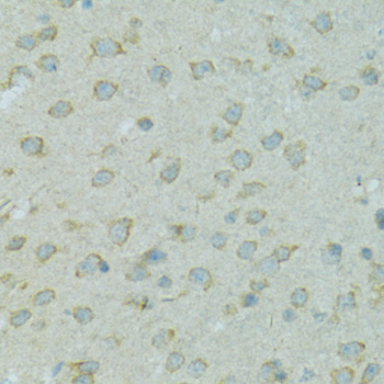 CYP2B6 Antibody - Immunohistochemistry of paraffin-embedded mouse brain using CYP2B6 antibodyat dilution of 1:100 (40x lens).