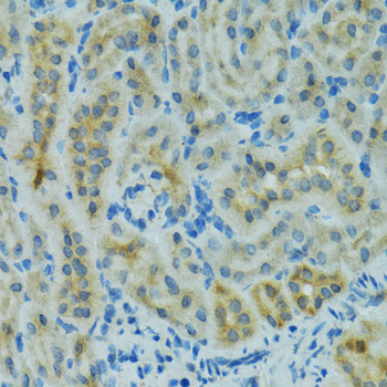 CYP2B6 Antibody - Immunohistochemistry of paraffin-embedded mouse kidney using CYP2B6 antibodyat dilution of 1:100 (40x lens).