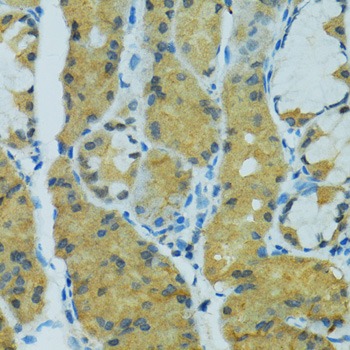 CYP2B6 Antibody - Immunohistochemistry of paraffin-embedded human stomach using CYP2B6 antibodyat dilution of 1:100 (40x lens).