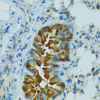CYP2B6 Antibody - Immunohistochemistry of paraffin-embedded mouse lung using CYP2B6 antibodyat dilution of 1:100 (40x lens).