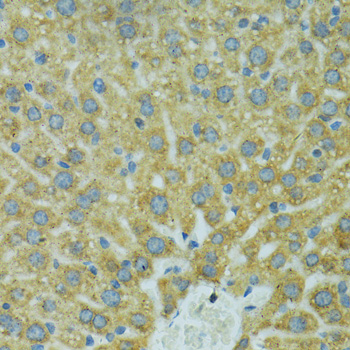 CYP2B6 Antibody - Immunohistochemistry of paraffin-embedded mouse liver using CYP2B6 antibodyat dilution of 1:100 (40x lens).