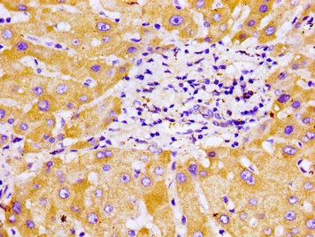 CYP2B6 Antibody - Immunohistochemistry image of paraffin-embedded human liver tissue at a dilution of 1:100