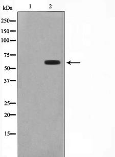 CYP2B6 Antibody - Western blot analysis on HT29 cell lysates using Cytochrome P450 2B6 antibody. The lane on the left is treated with the antigen-specific peptide.