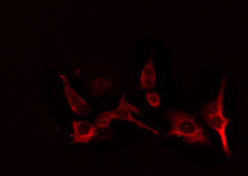 CYP2B6 Antibody - Staining HT29 cells by IF/ICC. The samples were fixed with PFA and permeabilized in 0.1% Triton X-100, then blocked in 10% serum for 45 min at 25°C. The primary antibody was diluted at 1:200 and incubated with the sample for 1 hour at 37°C. An Alexa Fluor 594 conjugated goat anti-rabbit IgG (H+L) antibody, diluted at 1/600, was used as secondary antibody.