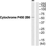 CYP2B6 Antibody - Western blot analysis of extracts from 293 cells, using Cytochrome P450 2B6 antibody.