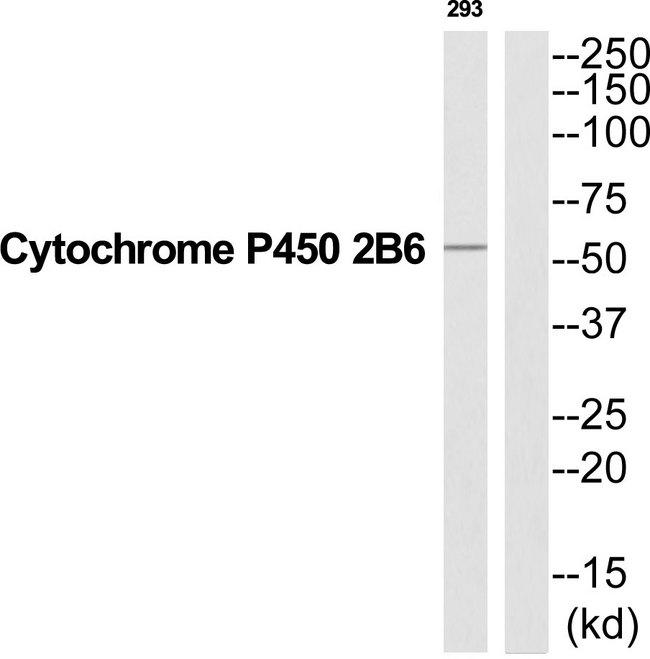 CYP2B6 Antibody - Western blot analysis of extracts from 293 cells, using Cytochrome P450 2B6 antibody.
