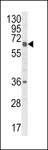 CYP2C18 / CYP2C Antibody - Western blot of CYP2C18 Antibody in HL-60 cell line lysates (35 ug/lane). CYP2C18 (arrow) was detected using the purified antibody.