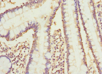 CYP2C18 / CYP2C Antibody - Immunohistochemistry of paraffin-embedded human small intestine tissue at dilution 1:100