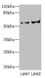 CYP2C18 / CYP2C Antibody - Western blot All Lanes: CYP2C18 antibody at 5.98ug/ml Lane 1: HL60 whole cell lysate Lane 2: 293T whole cell lysate Secondary Goat polyclonal to Rabbit IgG at 1/10000 dilution Predicted band size: 56,49 kDa Observed band size: 56 kDa