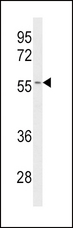 CYP2C19 Antibody - Western blot of CYP2C19 Antibody in Jurkat cell line lysates (35 ug/lane). CYP2C19 (arrow) was detected using the purified antibody.