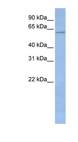 CYP2C19 Antibody - CYP2C19 antibody Western blot of Placenta lysate. This image was taken for the unconjugated form of this product. Other forms have not been tested.
