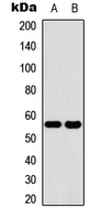 CYP2C19 Antibody - Western blot analysis of Cytochrome P450 2C19 expression in HeLa (A); human liver (B) whole cell lysates.