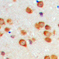 CYP2C19 Antibody - Immunohistochemical analysis of Cytochrome P450 2C19 staining in human brain formalin fixed paraffin embedded tissue section. The section was pre-treated using heat mediated antigen retrieval with sodium citrate buffer (pH 6.0). The section was then incubated with the antibody at room temperature and detected using an HRP-conjugated compact polymer system. DAB was used as the chromogen. The section was then counterstained with hematoxylin and mounted with DPX.