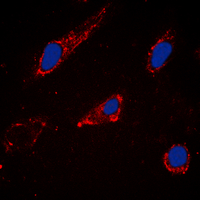 CYP2C19 Antibody - Immunofluorescent analysis of Cytochrome P450 2C19 staining in HeLa cells. Formalin-fixed cells were permeabilized with 0.1% Triton X-100 in TBS for 5-10 minutes and blocked with 3% BSA-PBS for 30 minutes at room temperature. Cells were probed with the primary antibody in 3% BSA-PBS and incubated overnight at 4 deg C in a humidified chamber. Cells were washed with PBST and incubated with a DyLight 594-conjugated secondary antibody (red) in PBS at room temperature in the dark. DAPI was used to stain the cell nuclei (blue).