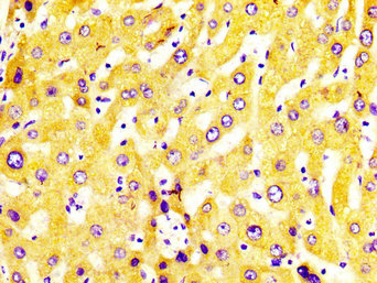 CYP2C19 Antibody - Immunohistochemistry image at a dilution of 1:400 and staining in paraffin-embedded human liver tissue performed on a Leica BondTM system. After dewaxing and hydration, antigen retrieval was mediated by high pressure in a citrate buffer (pH 6.0) . Section was blocked with 10% normal goat serum 30min at RT. Then primary antibody (1% BSA) was incubated at 4 °C overnight. The primary is detected by a biotinylated secondary antibody and visualized using an HRP conjugated SP system.