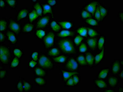 CYP2C19 Antibody - Immunofluorescence staining of Hela cells with CYP2C19 Antibody at 1:133, counter-stained with DAPI. The cells were fixed in 4% formaldehyde, permeabilized using 0.2% Triton X-100 and blocked in 10% normal Goat Serum. The cells were then incubated with the antibody overnight at 4°C. The secondary antibody was Alexa Fluor 488-congugated AffiniPure Goat Anti-Rabbit IgG(H+L).