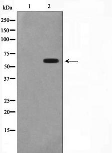 CYP2C19 Antibody - Western blot analysis on 293 cell lysates using Cytochrome P450 2C19 antibody. The lane on the left is treated with the antigen-specific peptide.