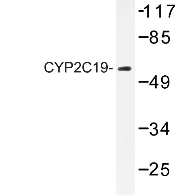 CYP2C19 Antibody - Western blot of CYP2C19 (K270) pAb in extracts from 293 cells.