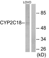 CYP2C8+9+18+19 Antibody - Western blot analysis of lysates from LOVO cells, using Cytochrome P450 2C8/9/18/19 Antibody. The lane on the right is blocked with the synthesized peptide.