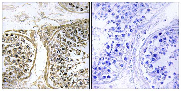 CYP2C8 Antibody - Immunohistochemistry analysis of paraffin-embedded human testis, using Cytochrome P450 2C8 Antibody. The picture on the right is blocked with the synthesized peptide.