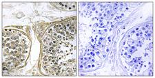 CYP2C8 Antibody - Immunohistochemistry analysis of paraffin-embedded human testis, using Cytochrome P450 2C8 Antibody. The picture on the right is blocked with the synthesized peptide.