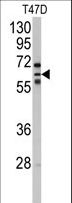 CYP2C8 Antibody - Western blot of anti-CYP2C8 Antibody in T47D cell line lysates (35 ug/lane). CYP2C8(arrow) was detected using the purified antibody.