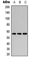 CYP2C8 Antibody - Western blot analysis of Cytochrome P450 2C8 expression in HEK293T (A); mouse kidney (B); mouse heart (C) whole cell lysates.