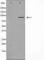 CYP2C8 Antibody - Western blot analysis of extracts of rat brain cells using Cytochrome P450 2C8 antibody. The lane on the left is treated with the antigen-specific peptide.