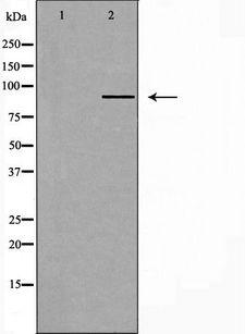 CYP2C8 Antibody - Western blot analysis of extracts of rat brain cells using Cytochrome P450 2C8 antibody. The lane on the left is treated with the antigen-specific peptide.
